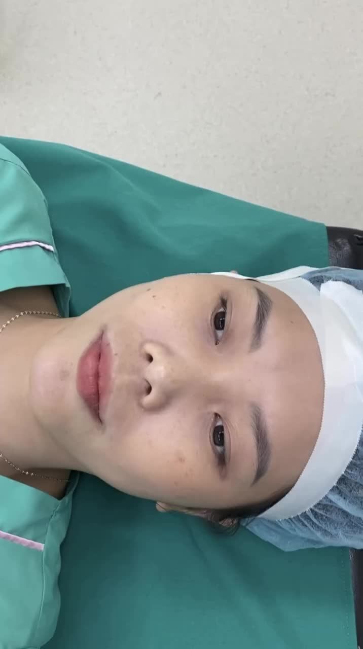 Nâng tầm nhan sắc với chiếc mũi cao sang thanh tú.