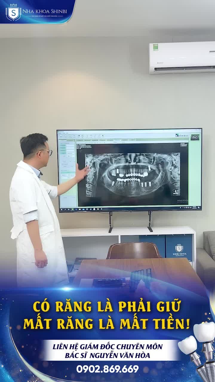 Tiền thuốc, tiền cháo, tiền dinh dưỡng bù… cộng lại đắt hơn một lần implant đúng chuẩn.