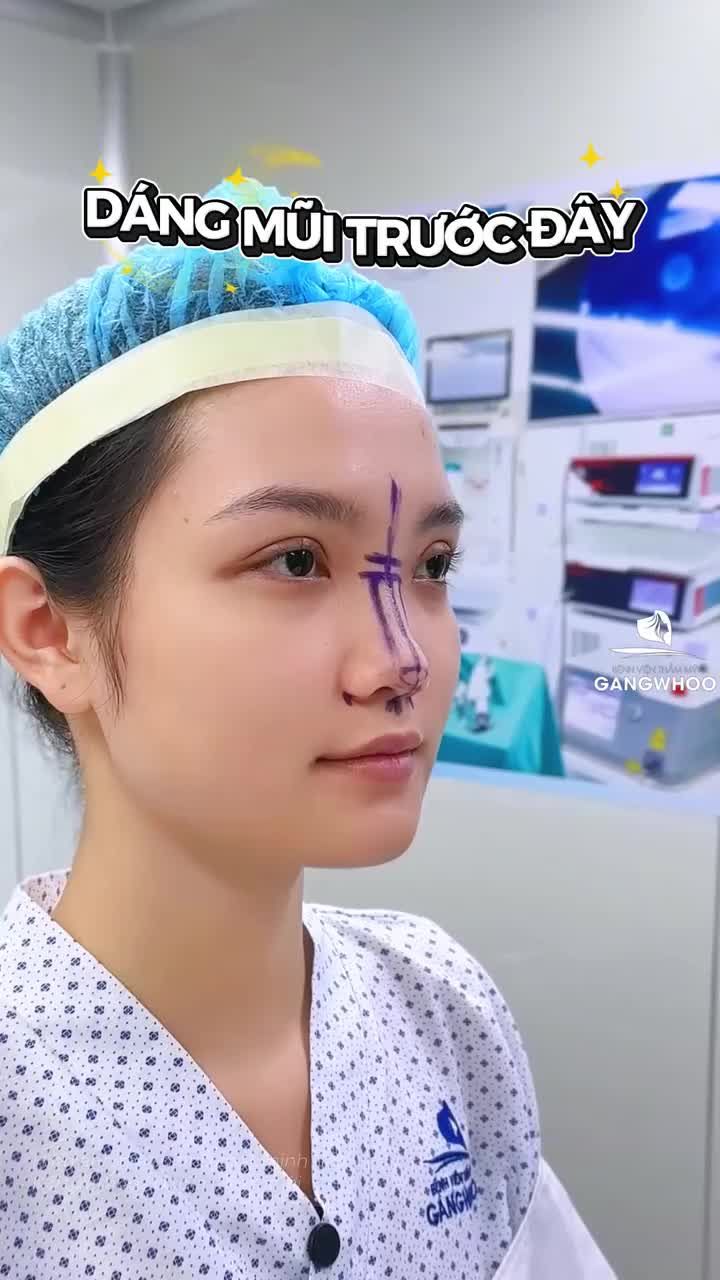 100 điểm cho chiếc mũi này
