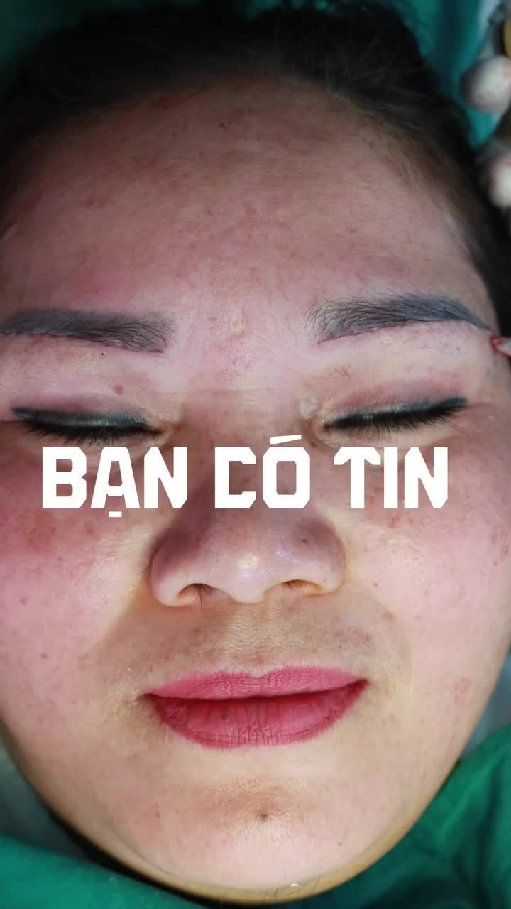 Lỗi Lão Hóa – Đừng Để Sụp Mí Che Lấp Ánh Nhìn Tươi Trẻ Của Bạn!