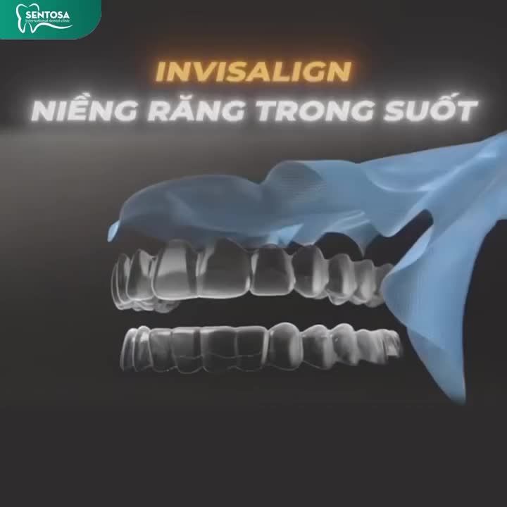 NỤ CƯỜI ĐẸP - KHÔNG CẦN “SẮT THÉP”!