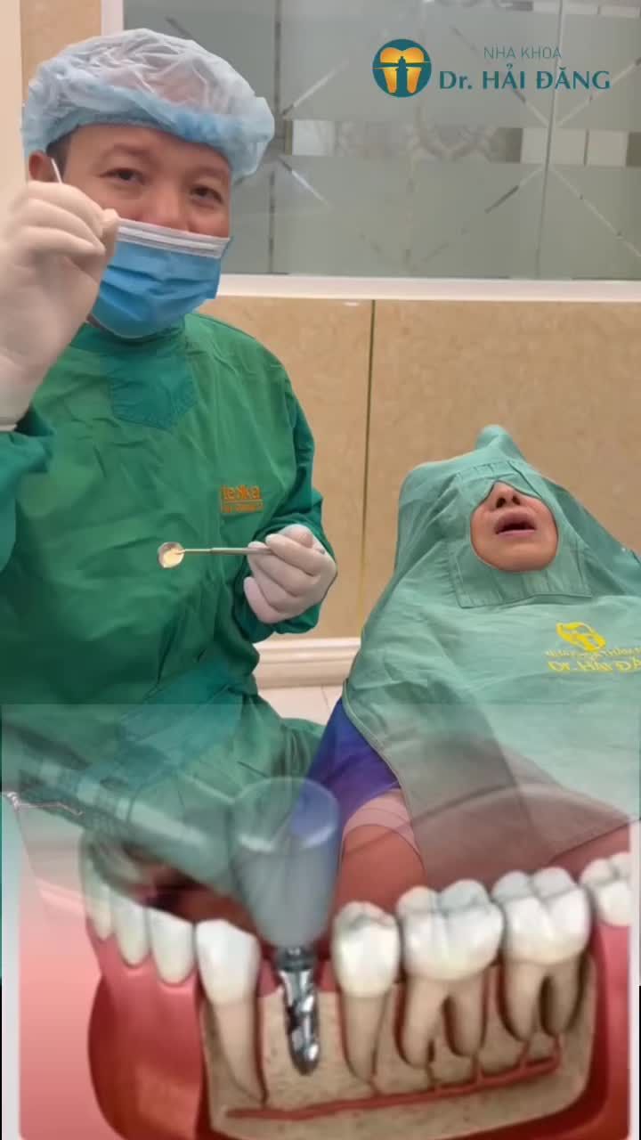 QUY TRÌNH MẤT RĂNG CẮM TRỤ IMPLANT CHƯA ĐẦY 5 PHÚT- NHANH- KHÔNG ĐAU - AN TOÀN