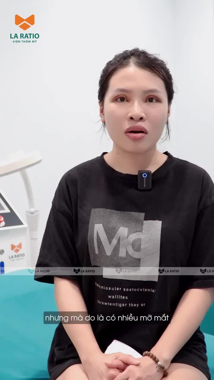 Mí xệ, da dư, mỡ mí nhiều khiến trang điểm mãi vẫn không đẹp?