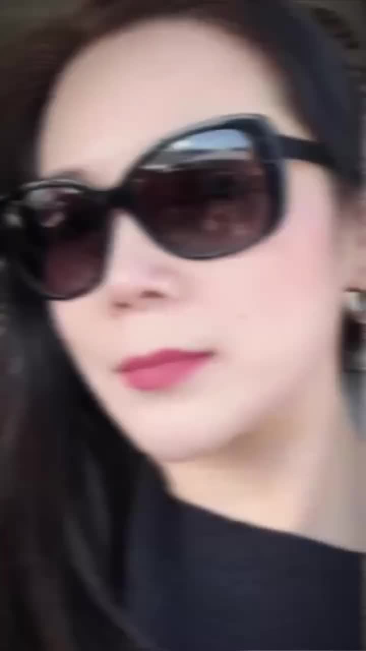 Combo "bất bại" sau 2 năm thực hiện mũi lót sụn chỉnh gồ + cắt cánh mũi kết hợp độn cằm, chị khách đã có được gương mặt thanh thoát, hài hòa hơn.