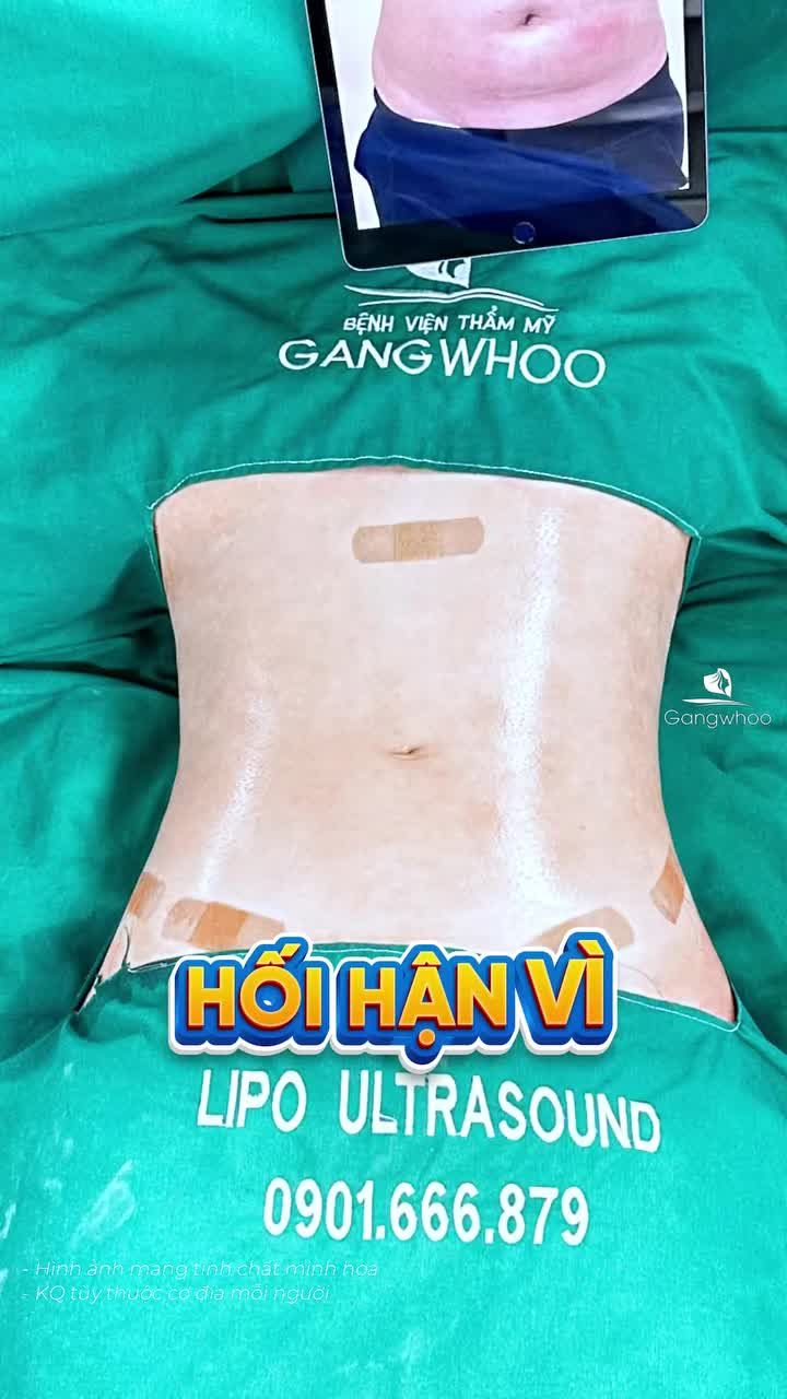 Lý do vì sao chị khách "hối hận" vì không đến Gangwhoo giảm mỡ sớm hơn