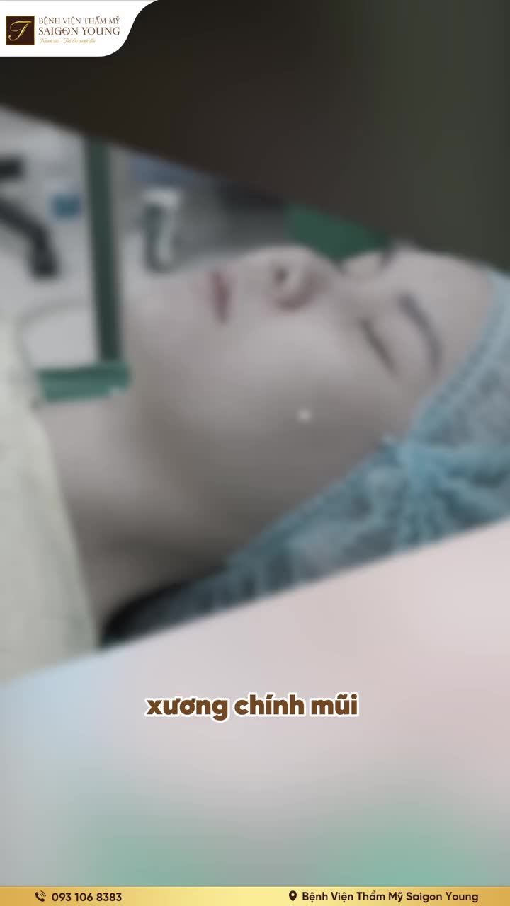 Diện mạo rạng rỡ, thanh thoát ngay sau nâng mũi