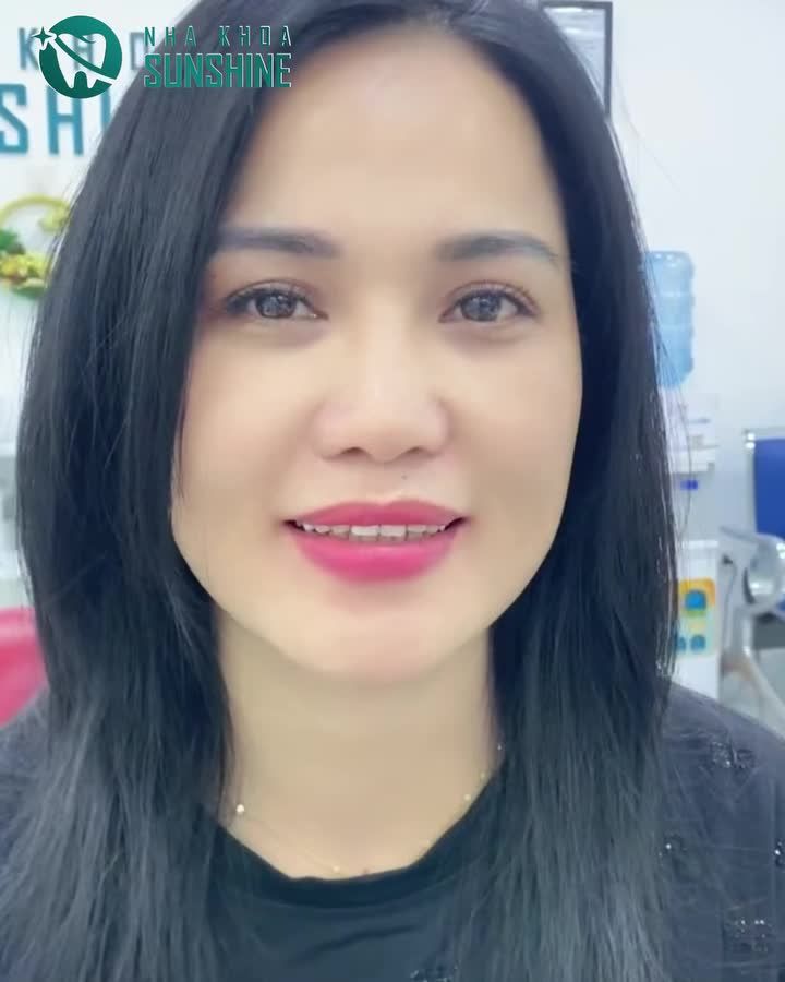 Những NỤ CƯỜI hài lòng tạo nên THƯƠNG HIỆU, Sự UY TÍN tạo nên những THÀNH CÔNG. Kết quả thẩm mỹ 18 răng toàn sứ cao cấp.