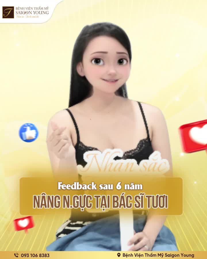 Sau 6 năm nâng V1 và sinh em bé, chị khách hạnh phúc với V1 không chảy xệ, ngày càng tự nhiên, sờ không thấy túi.