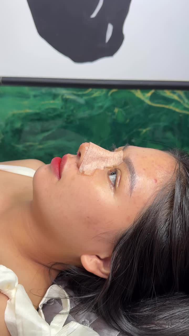 Combo mũi mí được 10 ngày - Đã vào form ổn định!