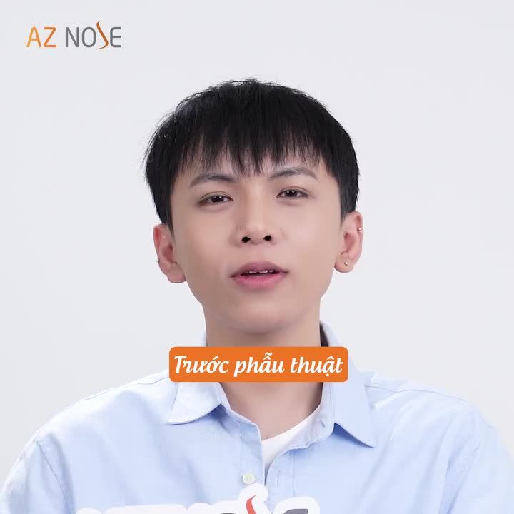 15 tiếng trước khi nâng mũi...