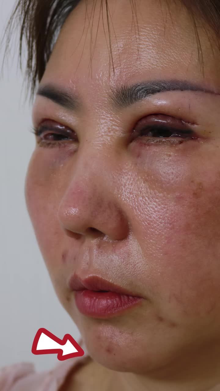 ĐÁNH THỨC V-LINE HOÀN HẢO – TỪ BỎ "CẰM LẸM, CẰM NGẮN" VĨNH VIỄN CHỈ SAU 60 PHÚT!