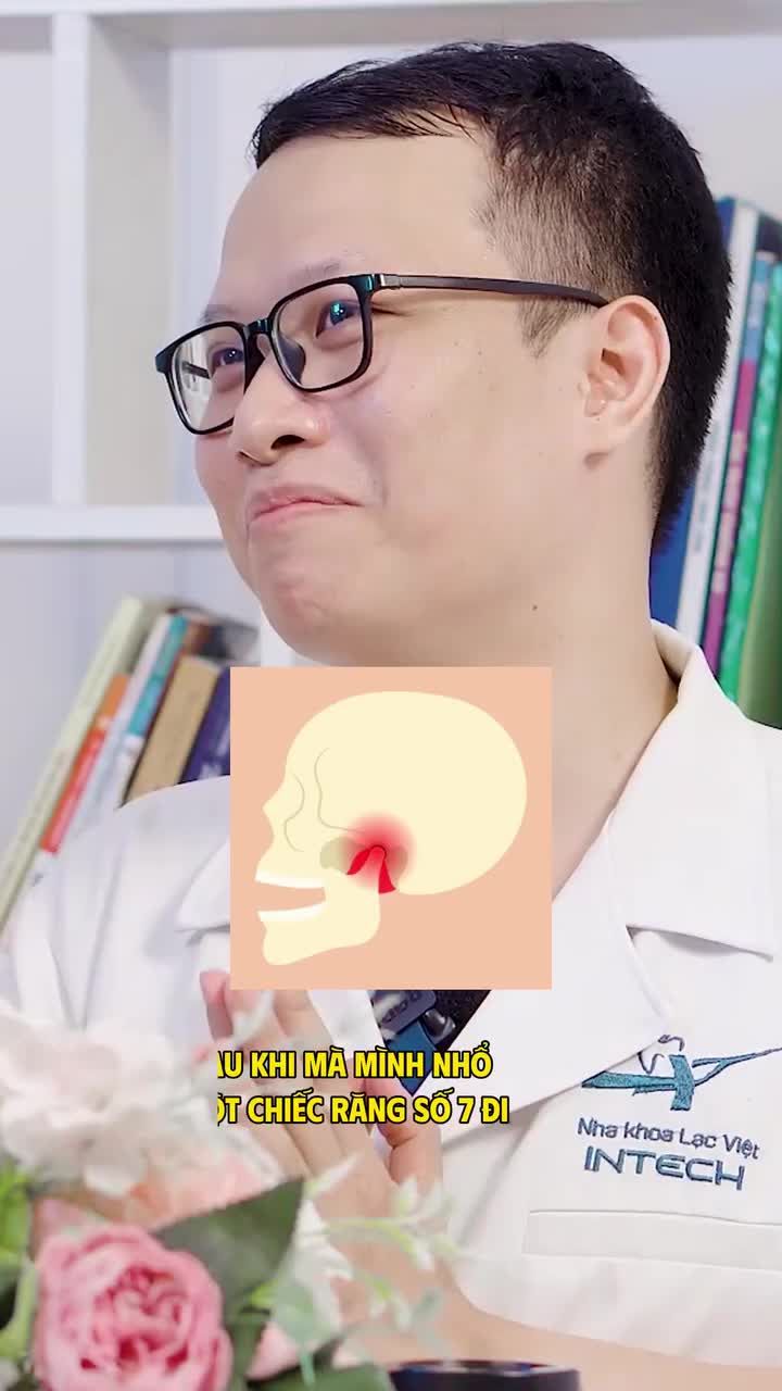 Nhổ răng 7 gây ra hậu quả gì?