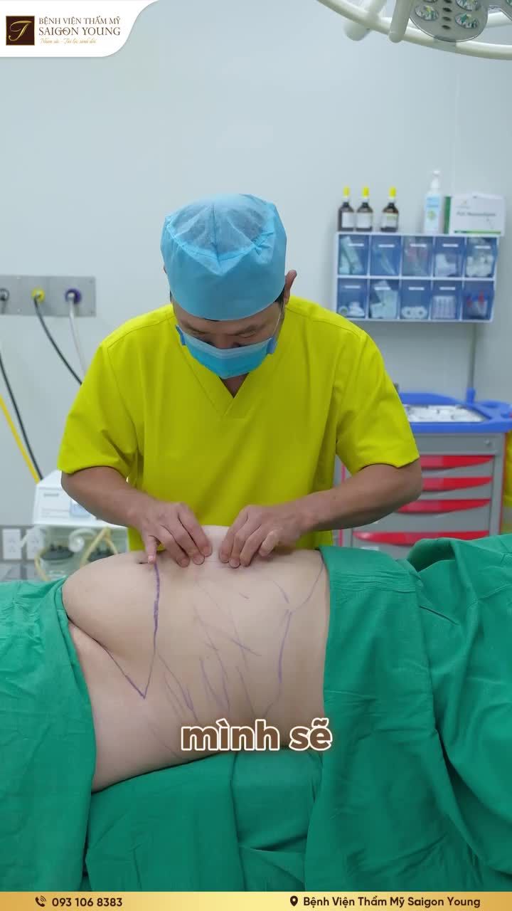 HÚT MỠ EO  CẮT DA TẠO HÌNH THÀNH BỤNG: LOẠI BỎ "TẢNG DA" KHỦNG SAU NHIỀU NĂM