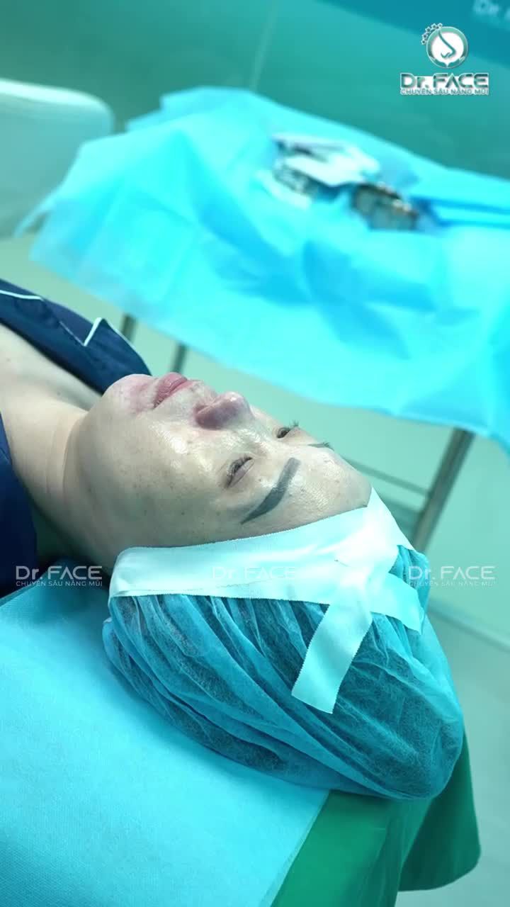 AI BẢO ĐỆM SỤN TAI LÀ KHÔNG ĐẸP?