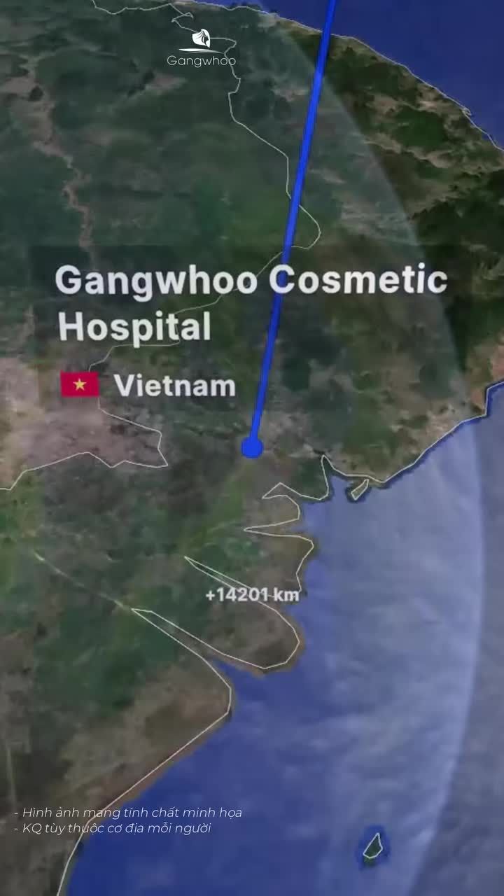 Việt kiều Mỹ chọn dịch vụ gì tại Gangwhoo? Cùng mình đón xem nha