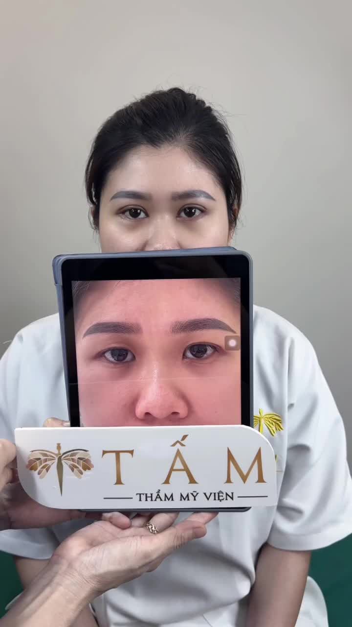 Lần đầu cắt em cũng lo lắm, nhưng trong lúc làm Bác Sĩ thao tác nhẹ nhàng nên em thấy không hề đau.
