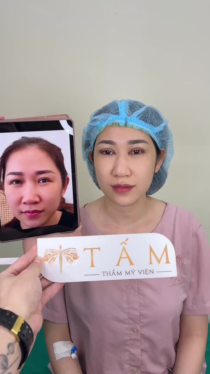 Từ đôi mắt sụp mí, góc trong rẻ quạt và góc ngoài ngắn