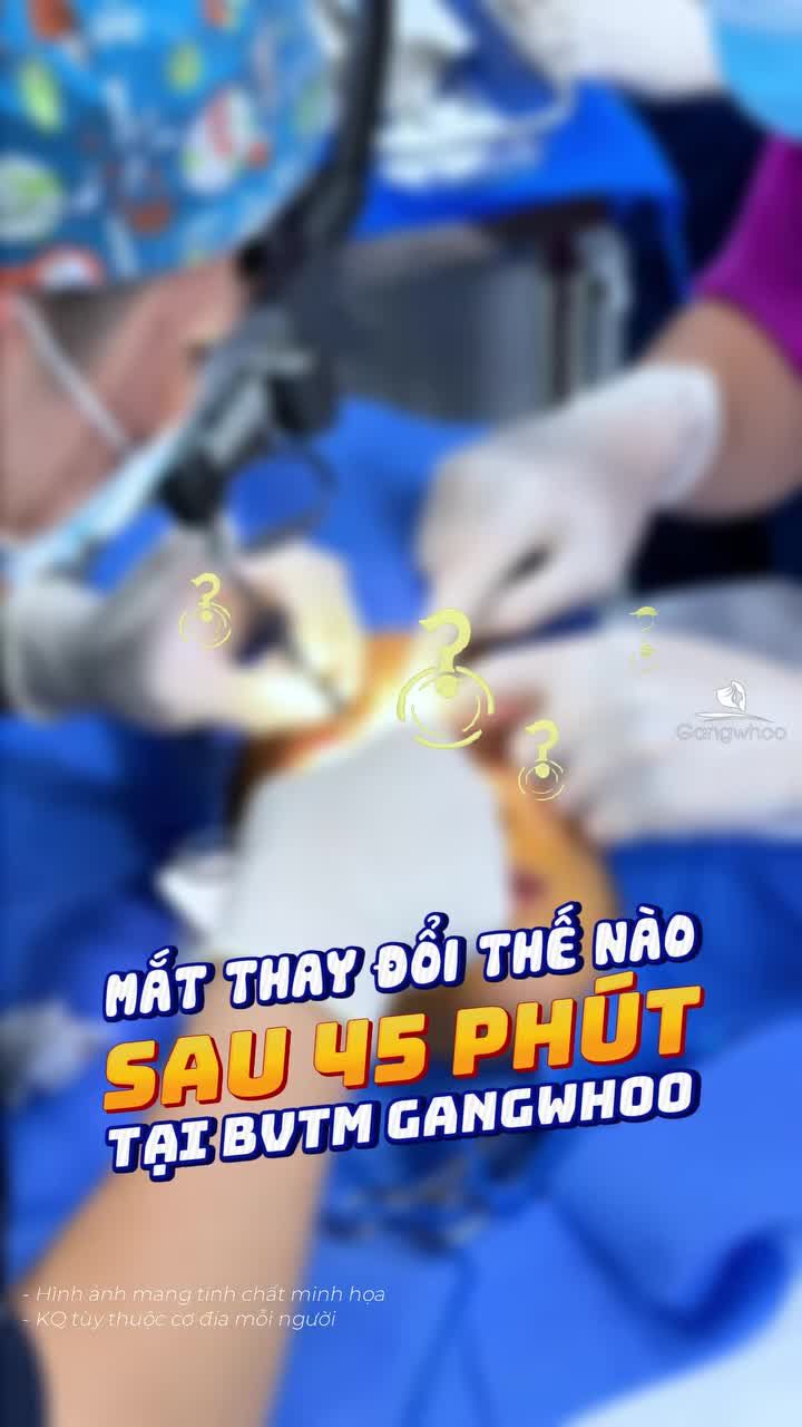Mắt bạn có đang gặp những khuyết điểm này? Hãy đặt lịch ngay để được Bác sĩ tại Gangwhoo tư vấn và lựa chọn giải pháp phù hợp nhất cho bạn!
