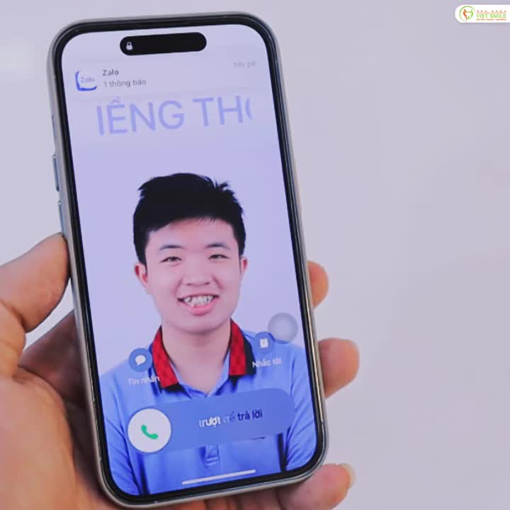 Nhận thấy răng hô và khấp khểnh khiến nụ cười chưa tự nhiên, gương mặt thiếu cân đối và đôi lúc mất tự tin khi giao tiếp, bạn Phan Thi đã quyết định tìm đến Viet Smile để thay đổi bản thân.