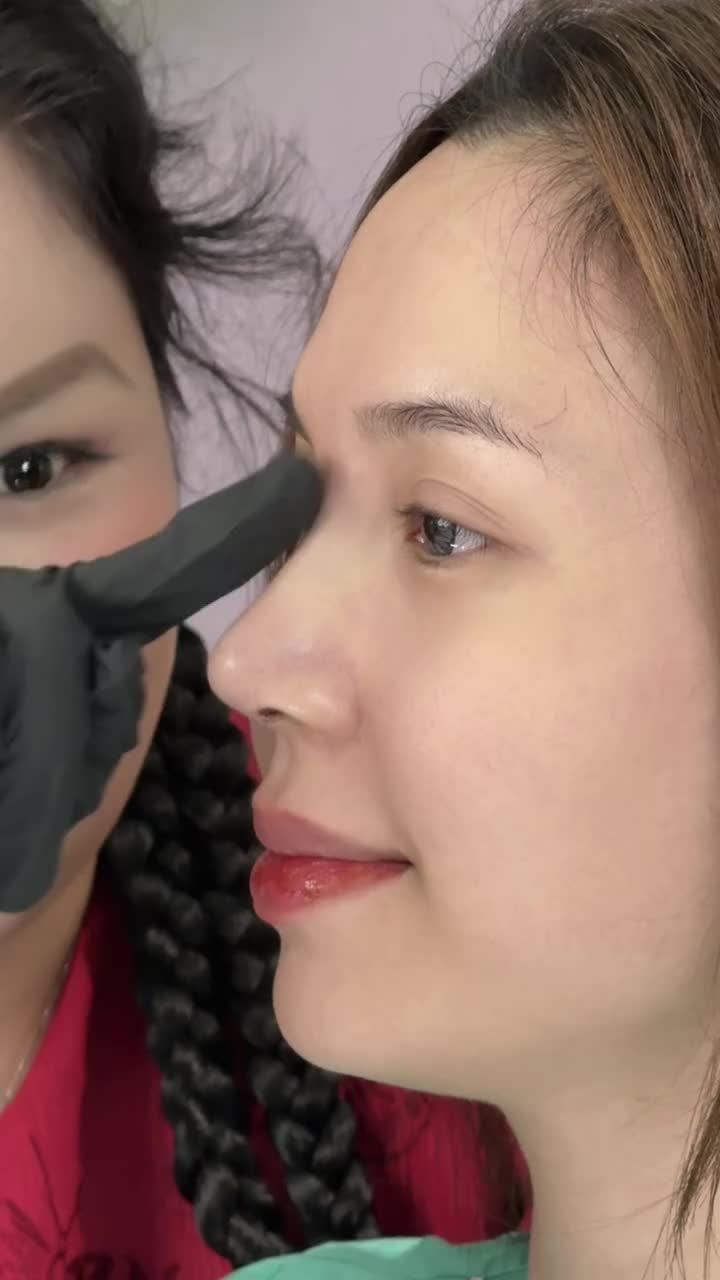Muốn nâng mũi đẹp hoàn hảo, bền chắc cùng thời gian => Chọn nâng mũi tại Tuấn Linh nha!!