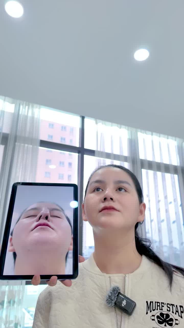 Bác nào hôm qua gọi cháy máy hỏi sửa mũi cấy trung bì đẹp không thì vào theo dõi live ngay nhé