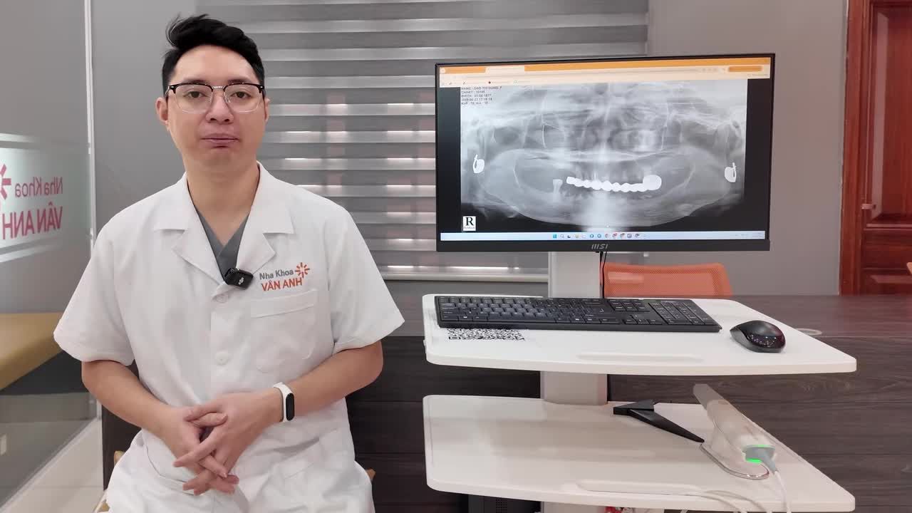 MẤT RĂNG TOÀN HAI HÀM, NHƯNG KHÔNG THỂ TRỒNG CỐ ĐỊNH