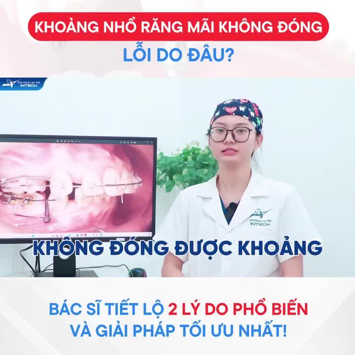 SOS NIỀNG RĂNG LÂU MÀ KHOẢNG NHỔ VẪN KHÔNG KHÉP!!!