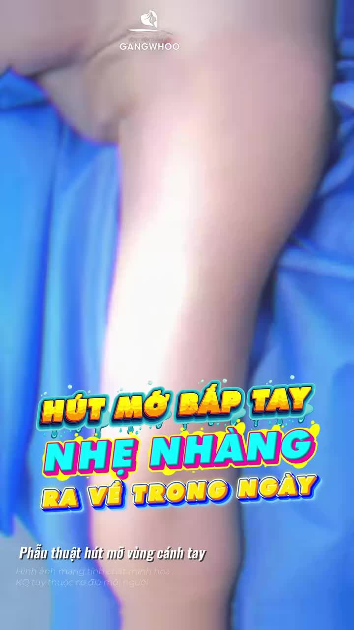 Khách hàng review 1 ngày đến Gangwhoo giảm mỡ bắp tay nhẹ nhàng, không đau, ra về trong ngày