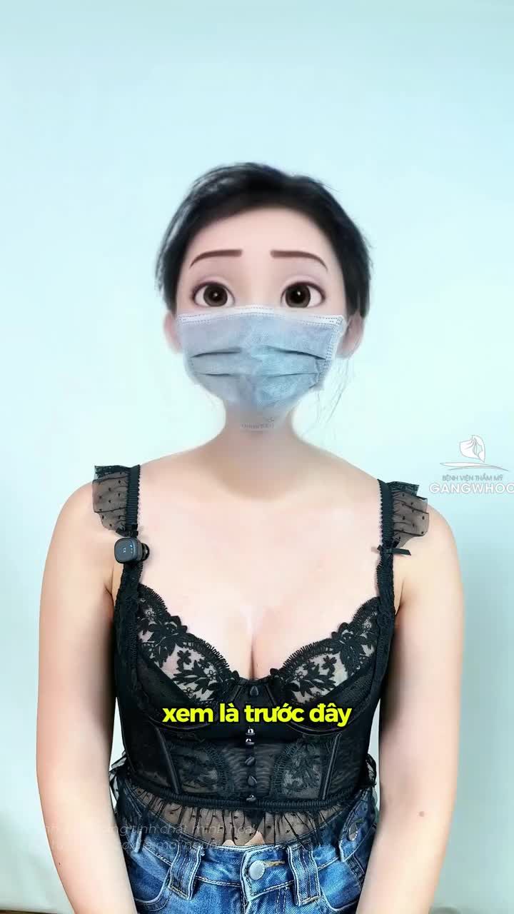 Kết quả tái khám sau 1 tháng nâng cấp vòng 1 tại Gangwhoo