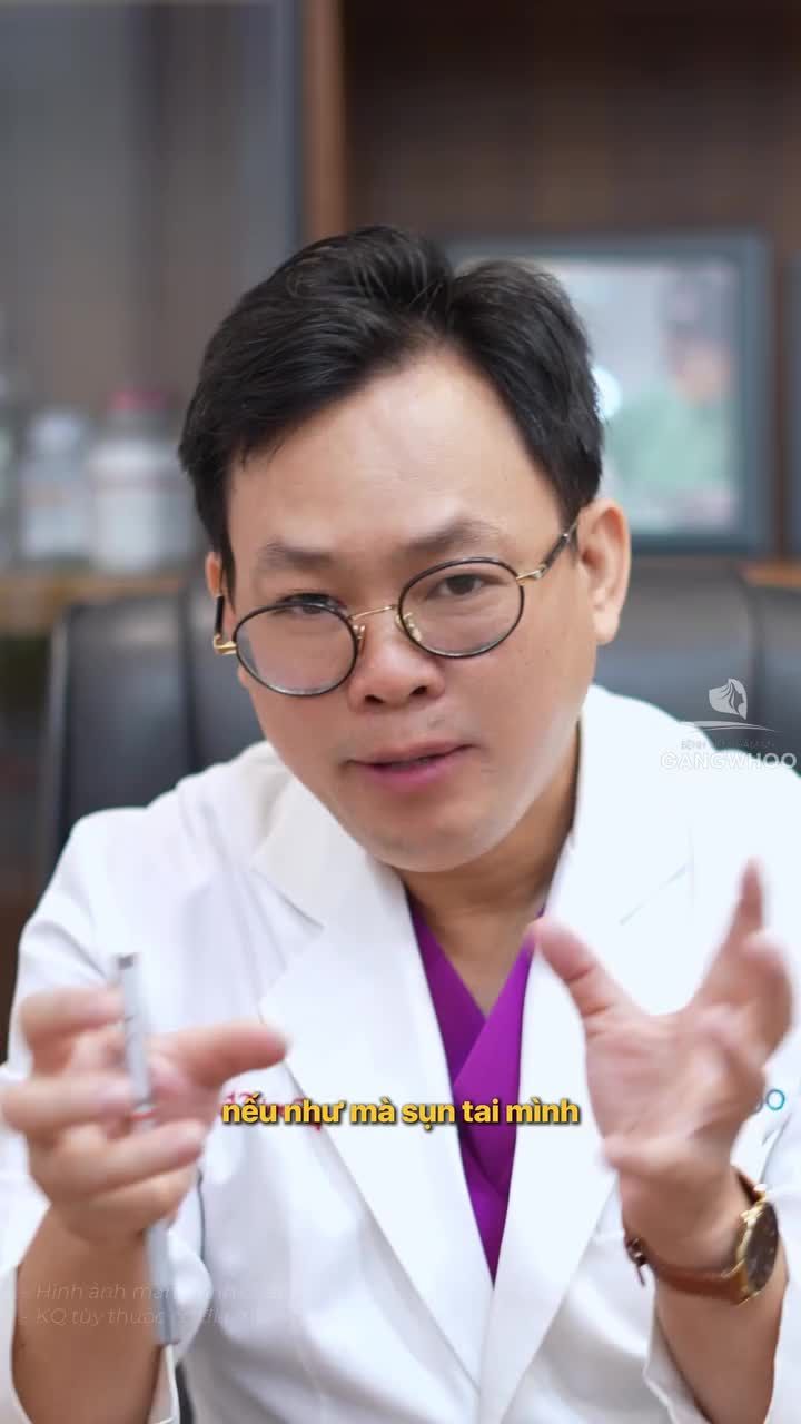 Sụn tai sau khi nâng mũi có bị teo đi không?