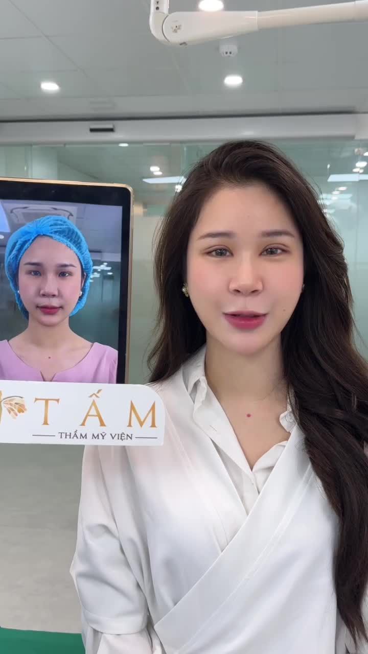 Cạn lời vì khách quá xinh sau combo Cắt mí Trên kết hợp Cấy Mỡ và Mở 2 Góc mắt không sẹo