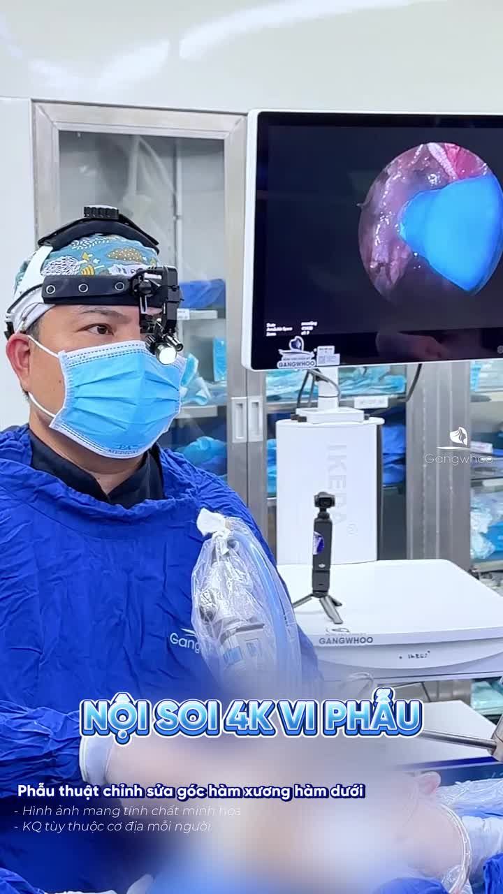 Kết quả phẫu thuật chỉnh sửa góc hàm xương hàm dưới sau 15 ngày của chàng trai du học sinh gen Z