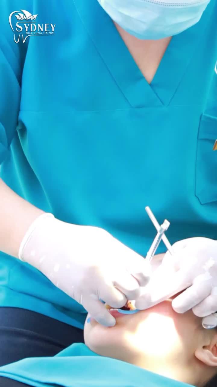 5 Lỗi sai khi niềng răng khiến bạn phải hối hận