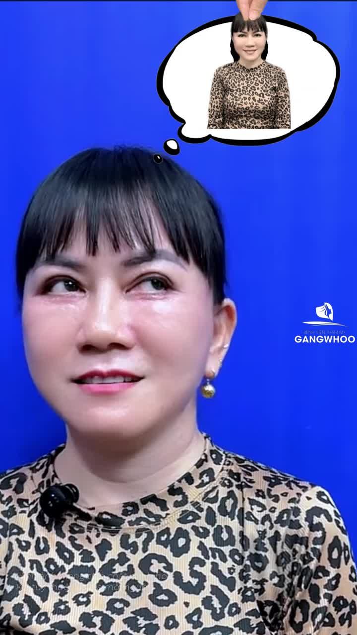 Một diện mạo mới trẻ lại 10 tuổi sau thực hiện căng da mặt Smas nội soi 4K