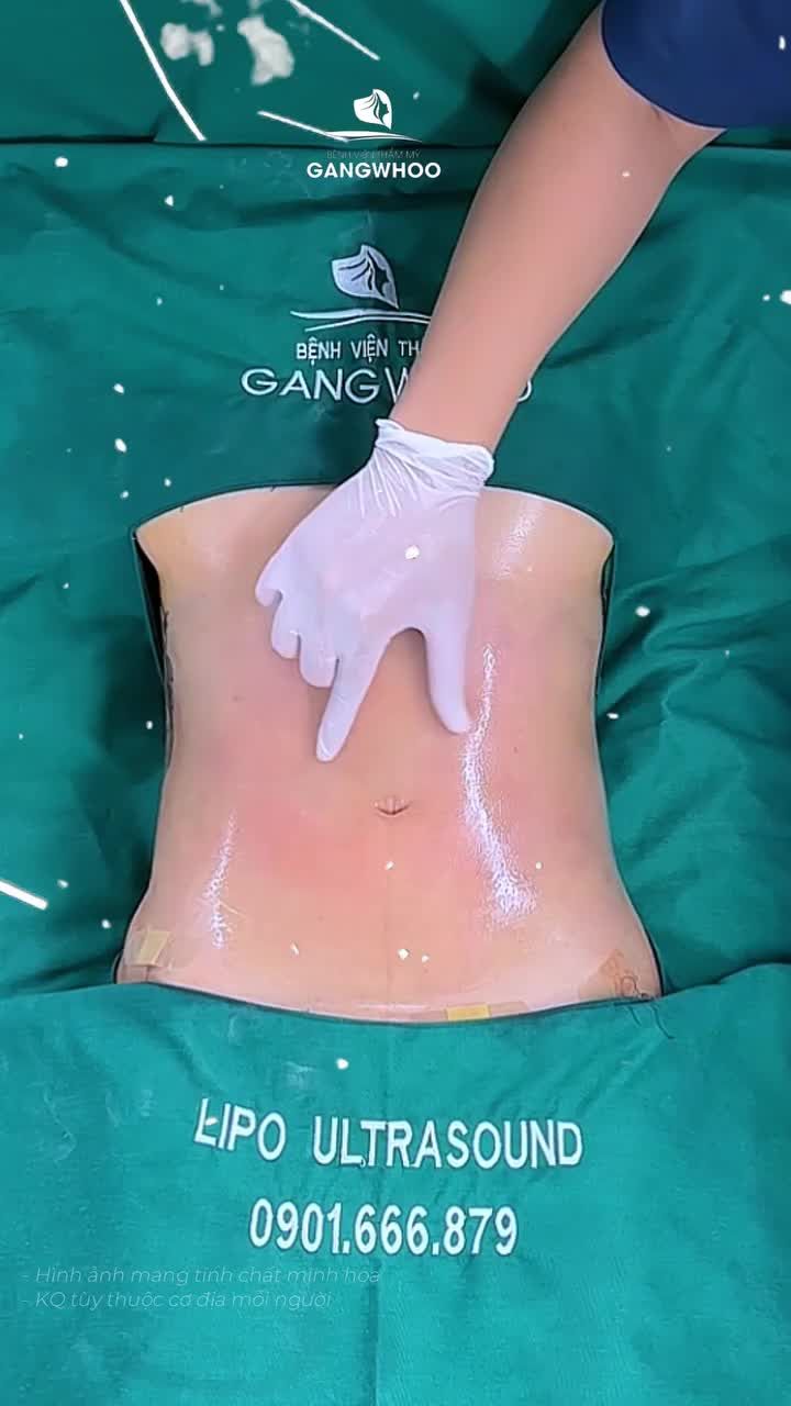 Qua tìm hiểu người thân đã từng làm đẹp, chị khách đặt niềm tin tại Gangwhoo với hy vọng lấy lại vóc dáng sau bao năm làm mẹ.