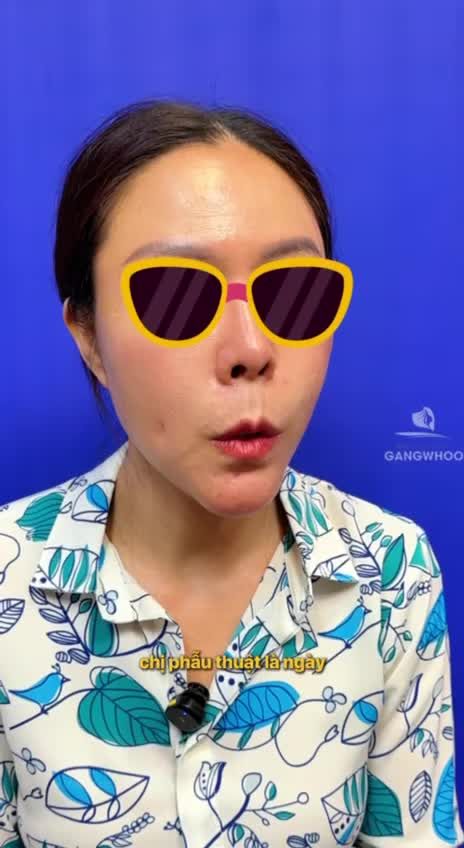 Ca phẫu thuật cách đây 2 tuần được chị chia sẻ chân thực: