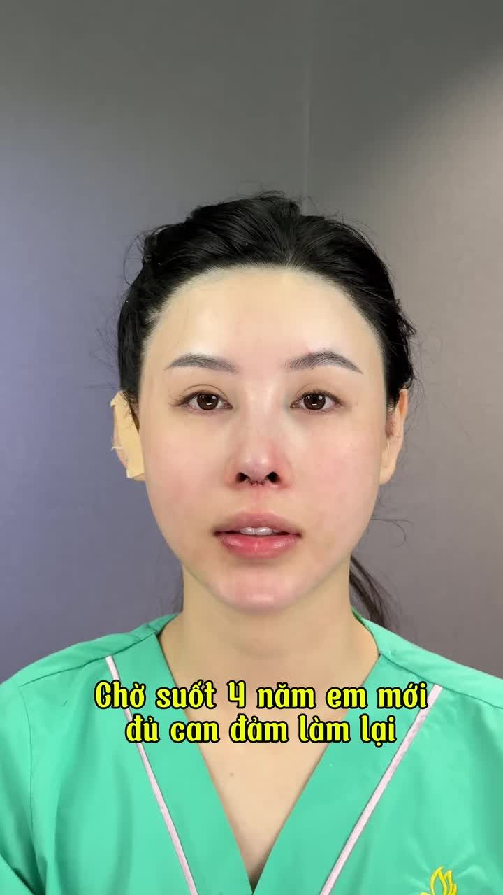 NÂNG MŨI SỬA LẠI - TINH CHỈNH TỪNG CHI TIẾT ĐẸP HOÀN HẢO!