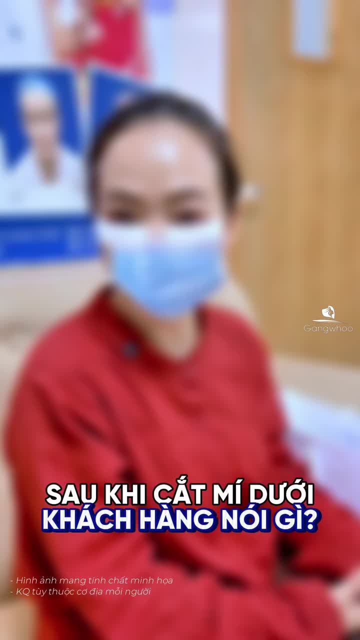 Khách hàng vừa trải qua dịch vụ cắt mí dưới, cùng lắng nghe chia sẻ của chị về trải nghiệm tại Gangwhoo nhé