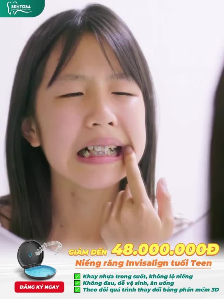 GIẢM ĐẾN 48.000.000Đ TRỌN GÓI NIỀNG RĂNG INVISALIGN TUỔI TEEN