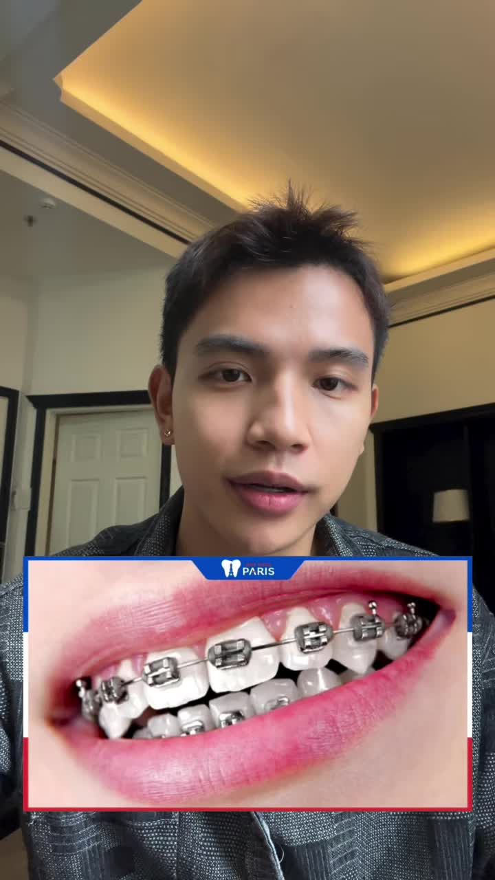 8 THÁNG NIỀNG INVISALIGN CỦA DIỄN VIÊN VIỆT HOÀNG: TỰ TIN VÀ TỰ NHIÊN!