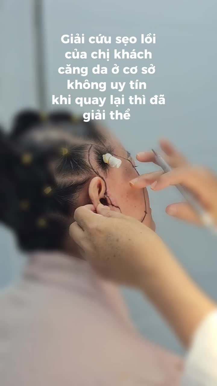 Từng tin vào lời quảng cáo “căng da không sẹo, giá rẻ bất ngờ”