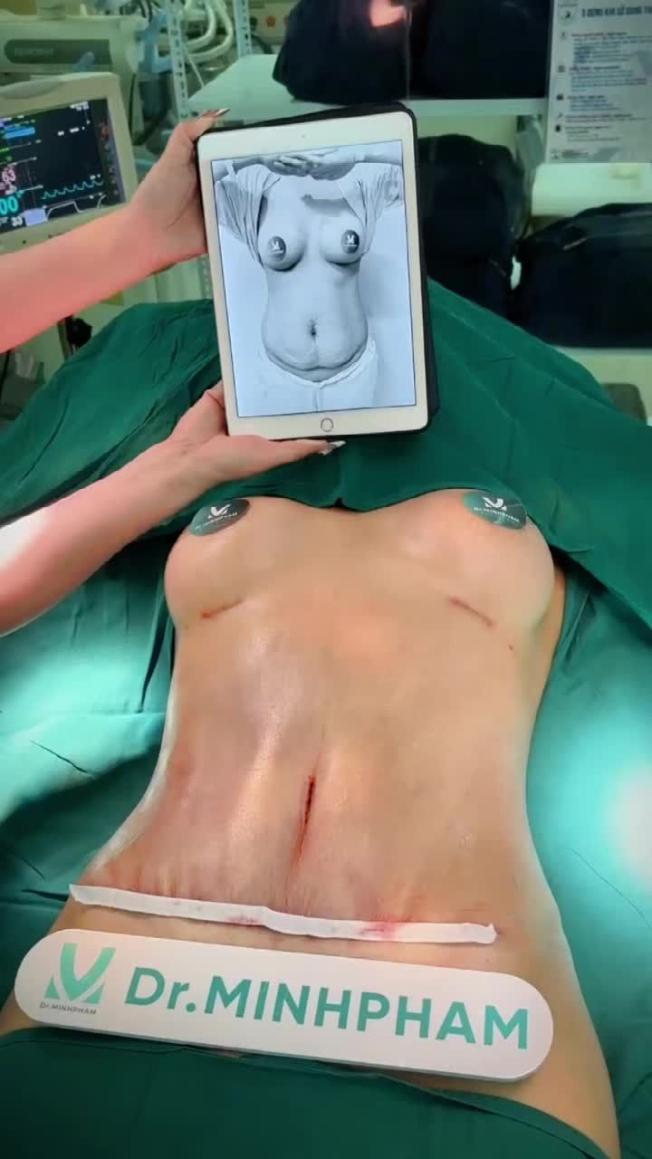 Từ eo bánh mì eo con kiến cùng Dr. Minh Phạm