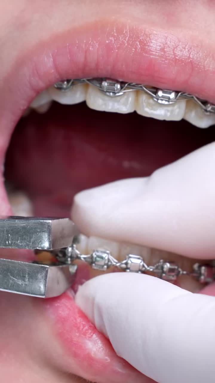 KHOẢNH KHẮC THÁO NIỀNG – NỤ CƯỜI MỚI, TỰ TIN HƠN MỖI NGÀY