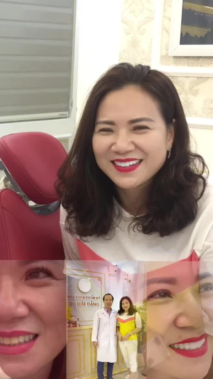 20 răng sứ đẹp hay không, phụ thuộc vào tay nghề của bác sĩ