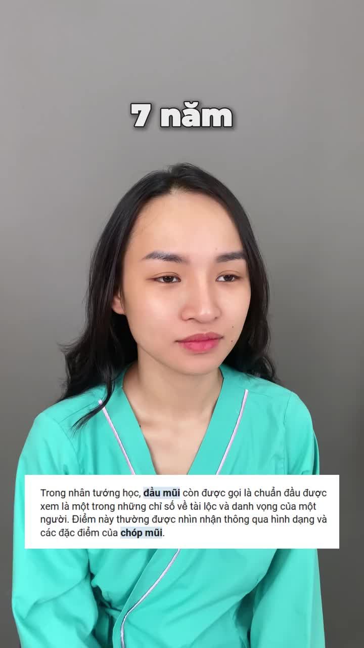 Bé khách đã từng làm mũi tại Tuấn Linh bạn quay trở lại để nâng cấp lên dáng mũi phù hợp hơn.