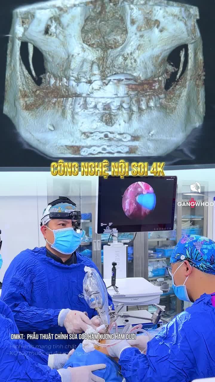 CÔ ẤY SẼ THAY ĐỔI NHƯ THẾ NÀO SAU GỌT HÀM?