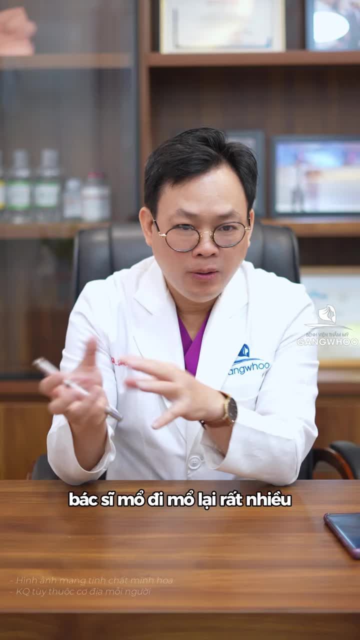Sửa mũi lại có nhất thiết phải sử dụng sụn sườn không?