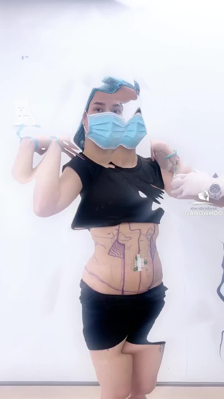 Đến Gangwhoo giảm mỡ Lipo Ultrasound để có eo xinh lung linh kịp đón Tết nhé cả nhà