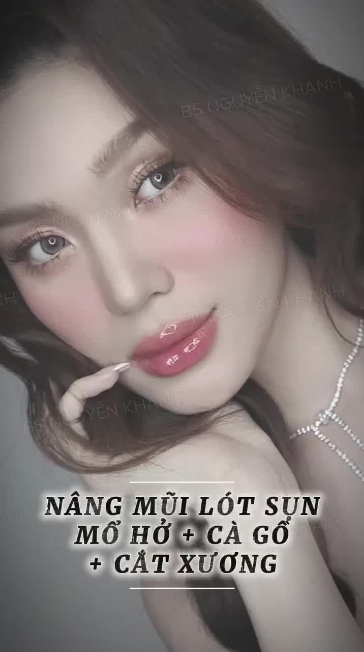 Một dáng mũi thanh thoát, tự nhiên, hài hòa cùng khuôn mặt là điều ai cũng mong muốn.