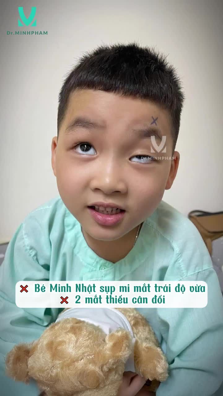 Bé Minh Nhật sau 20 ngày phẫu thuật sụp mi bẩm sinh lấy lại tự tin cùng đôi mắt sáng